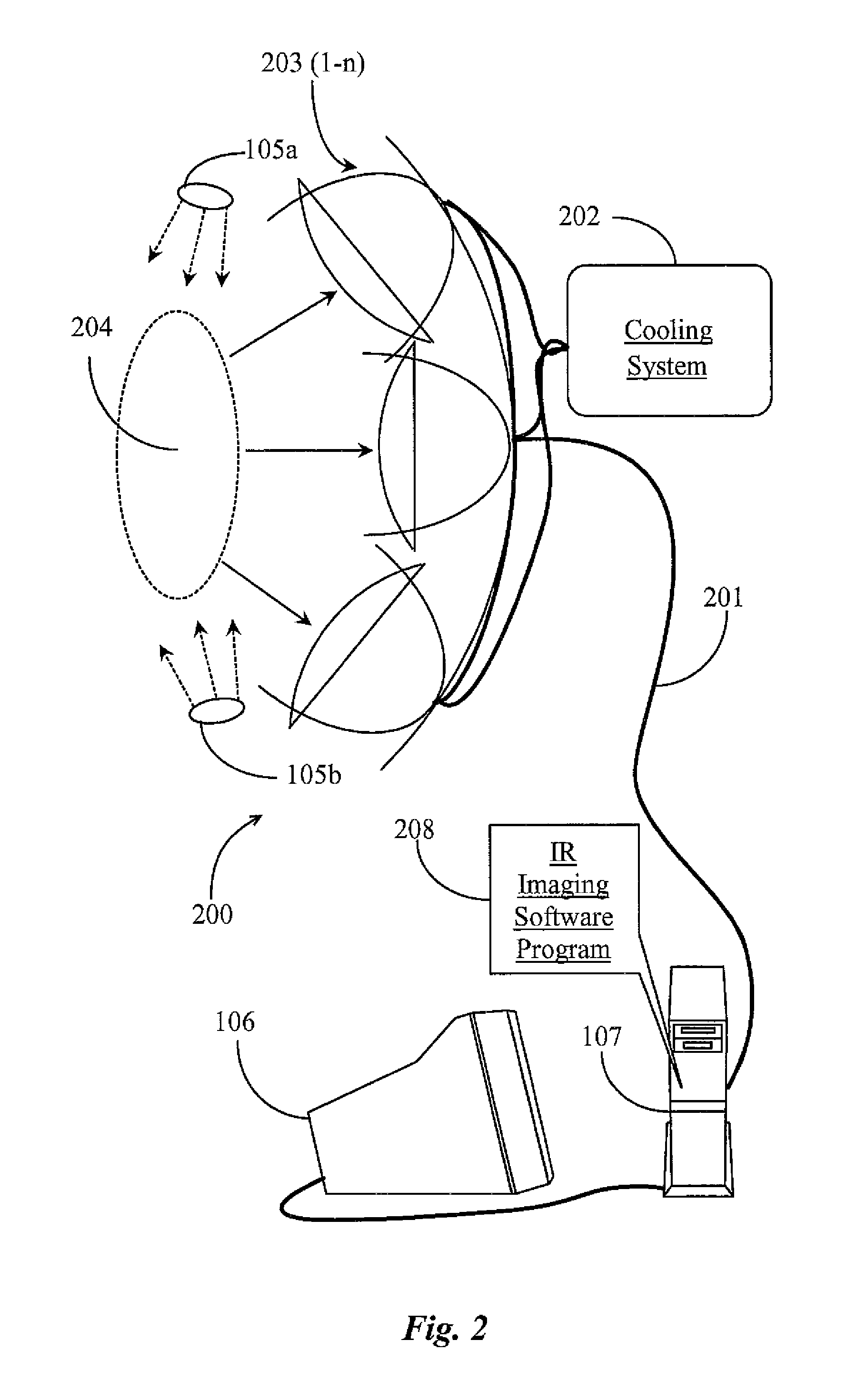 Method for Detecting and/or Monitoring a Wound Using Infrared Thermal Imaging