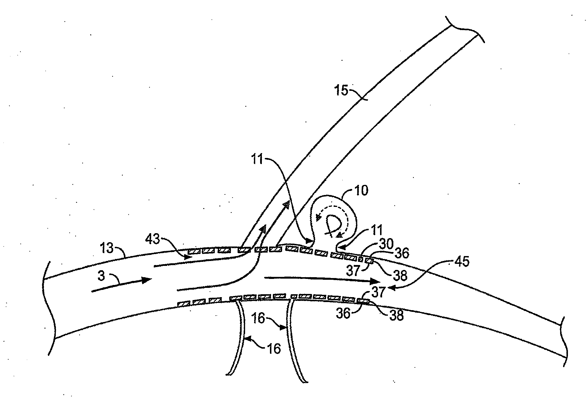 Procedures for vascular occlusion