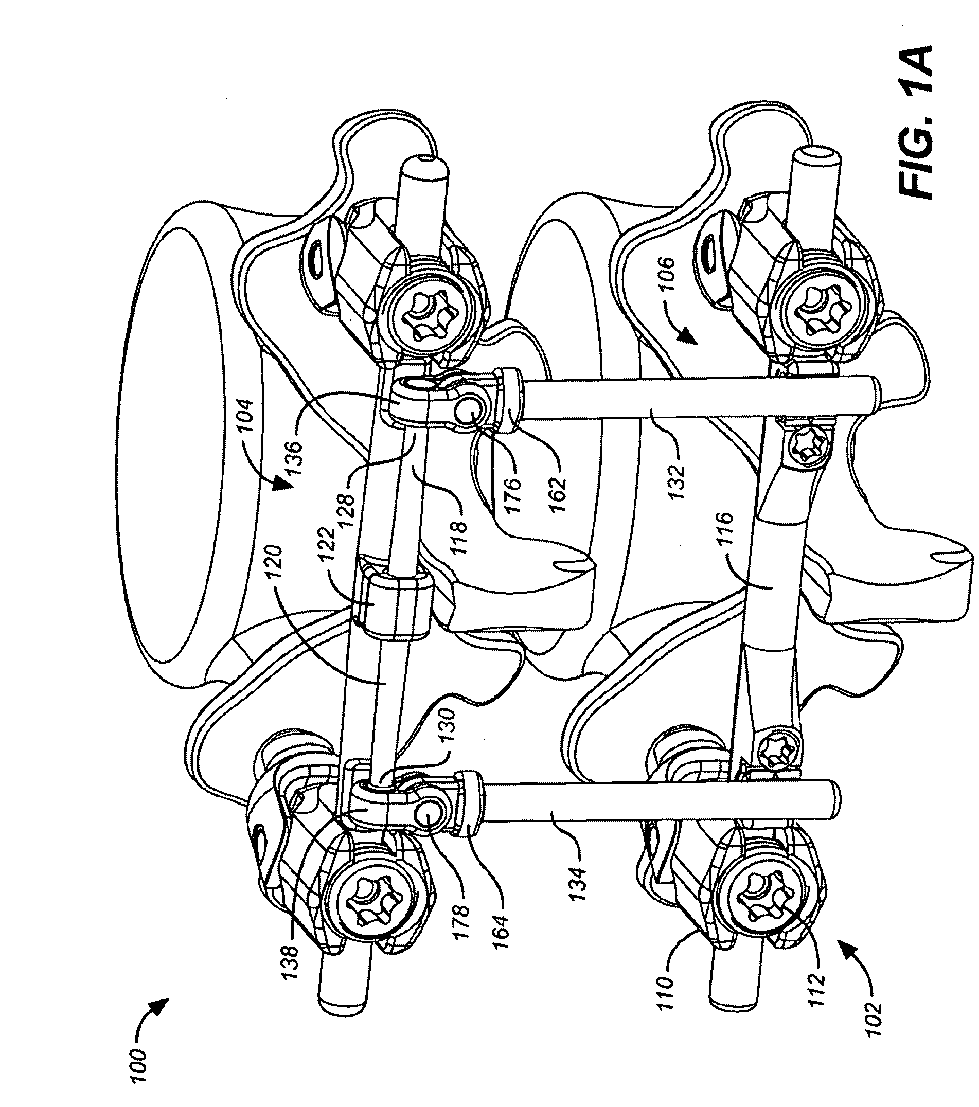 Dual deflection rod system for a dynamic stabilization and motion preservation spinal implantation system and method