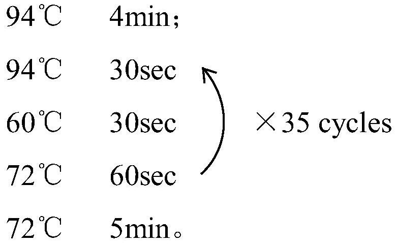 Molecular marker for detecting COVID-19 susceptibility, kit and application