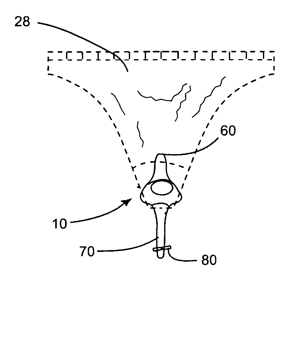 Incontinence device