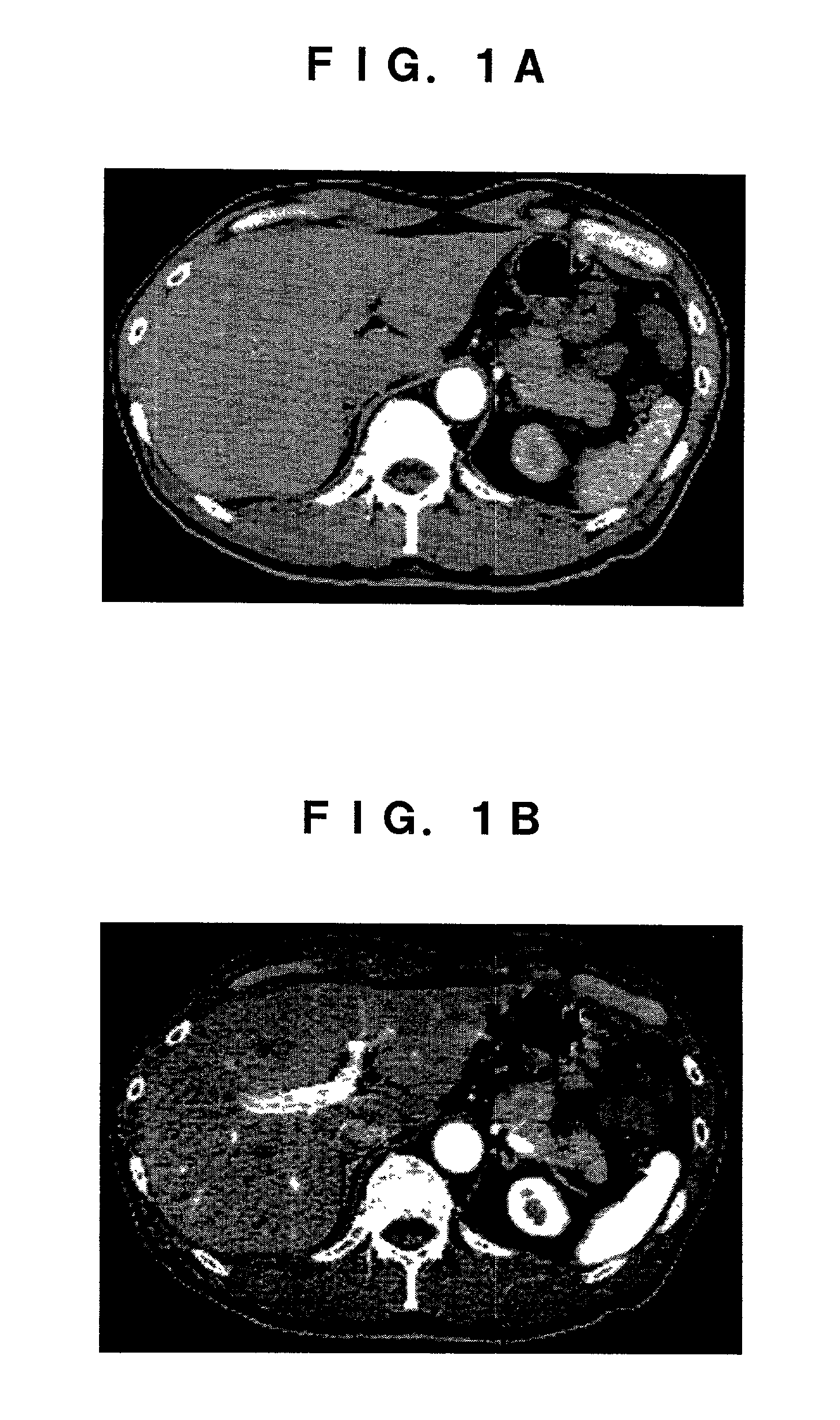 Region extracting method for medical image