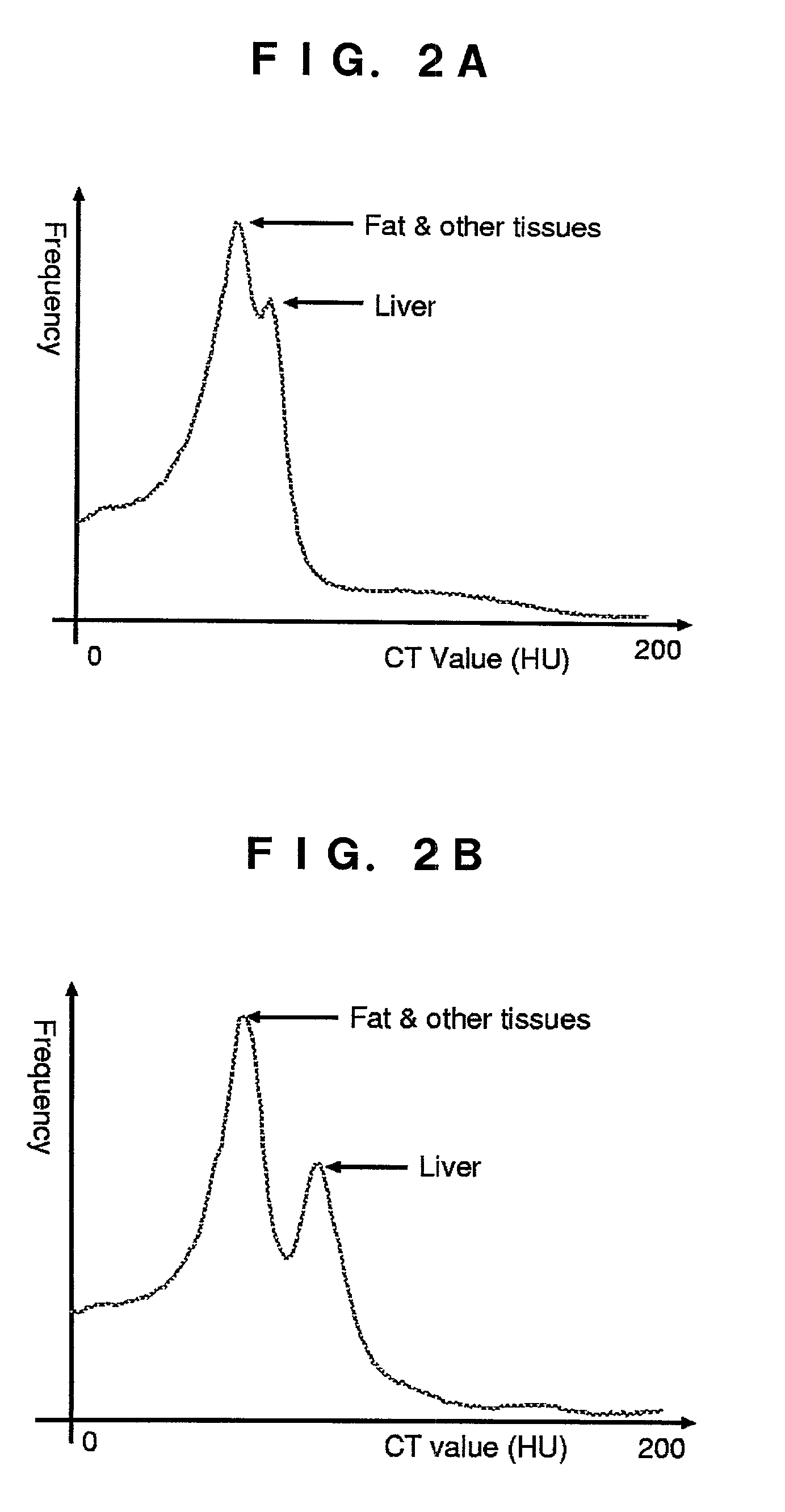 Region extracting method for medical image