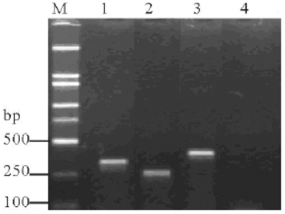 Lily virus gene chip and preparation method thereof as well as method for detecting lily viruses using lily virus gene chip