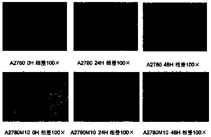 A highly metastatic human ovarian cancer cell line derived from lung metastases and its establishment and application