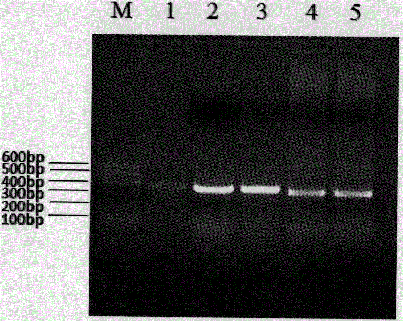 A kind of anti-p21ras protein single-chain antibody and its application