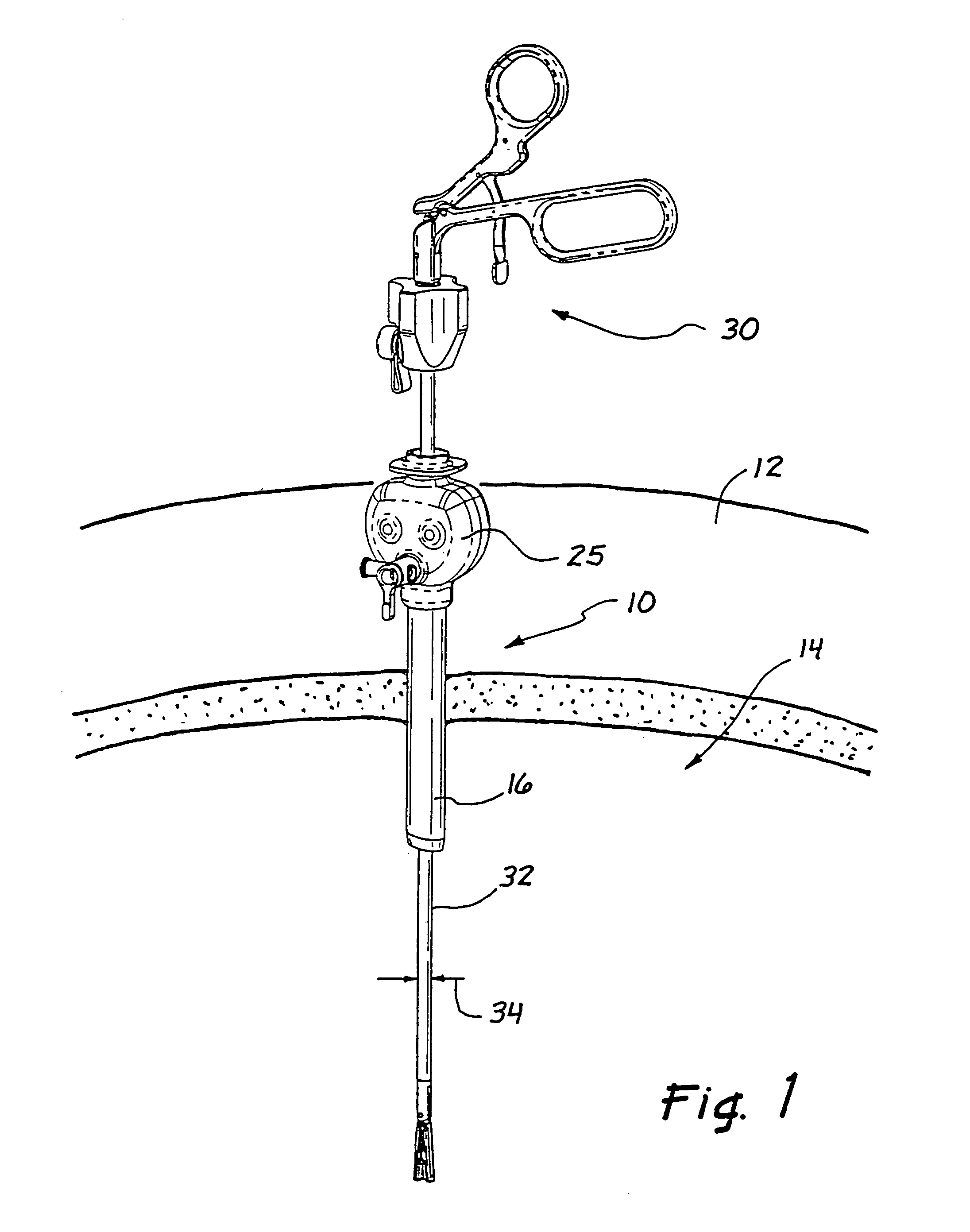 Access device maintenance apparatus and method