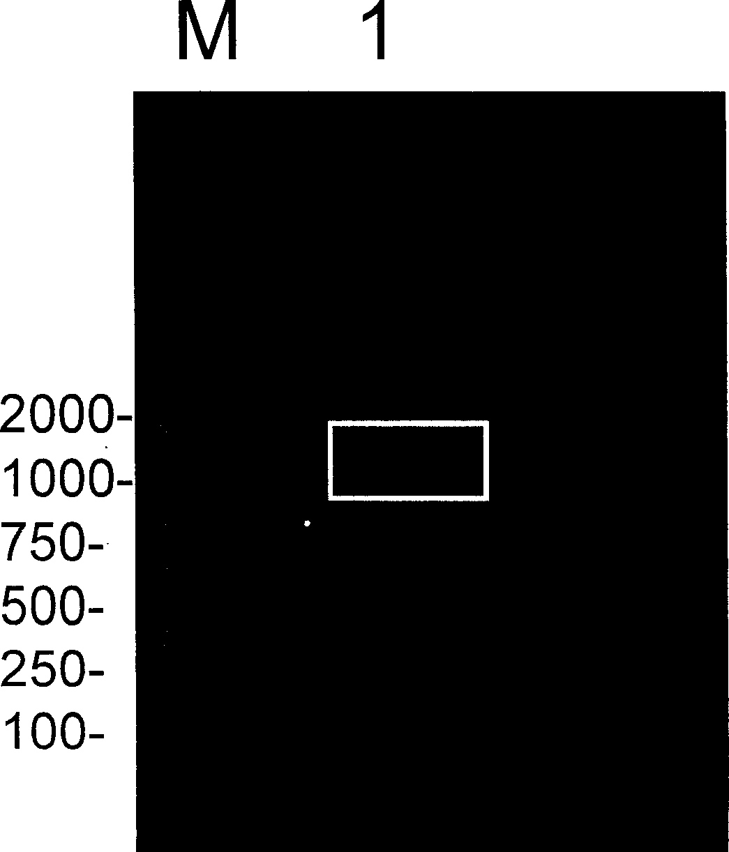 Conjugated protein Tau of microtubule of earthworm, its coding gene, and application