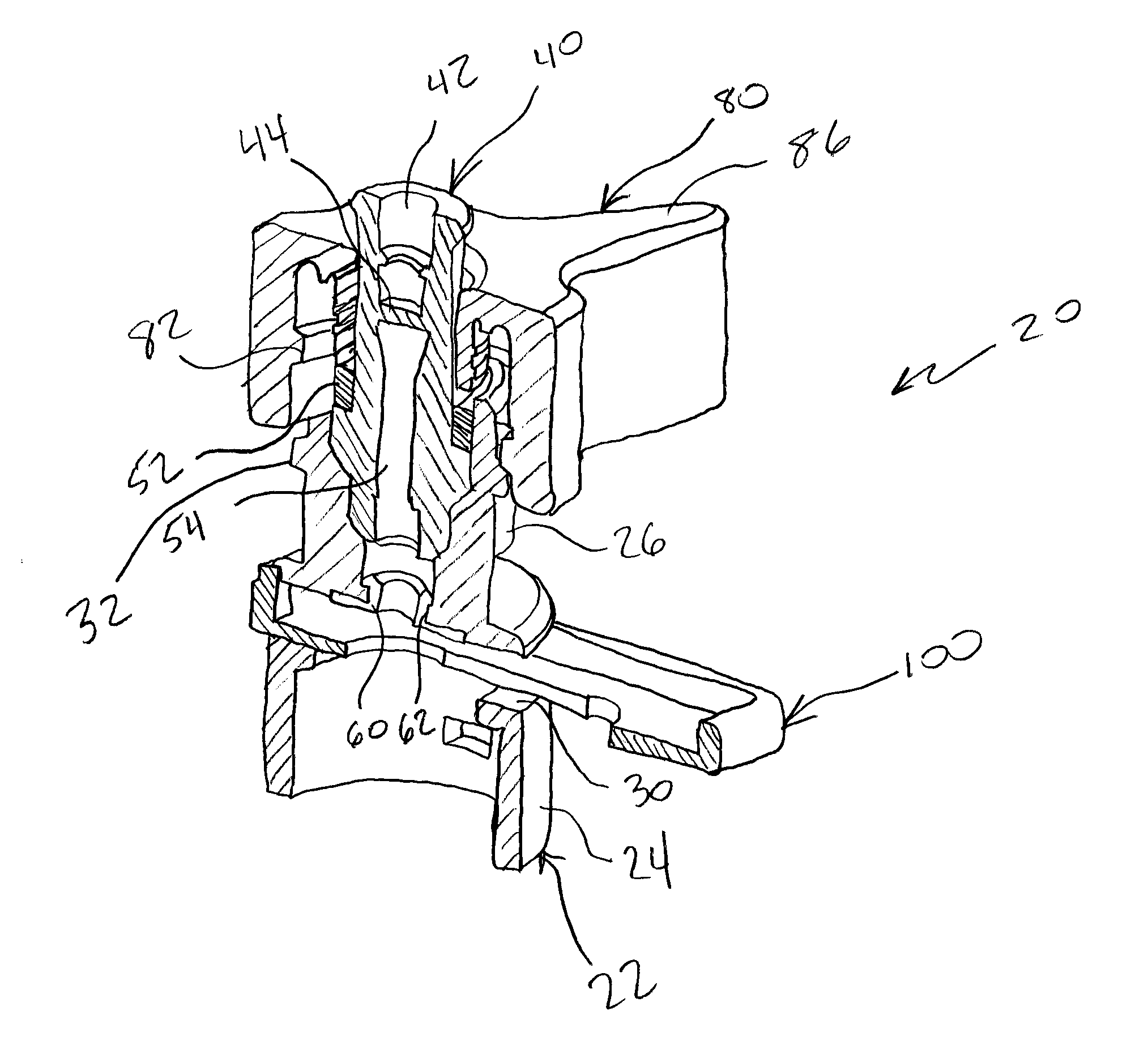 Bronchoscope Adapter and Method