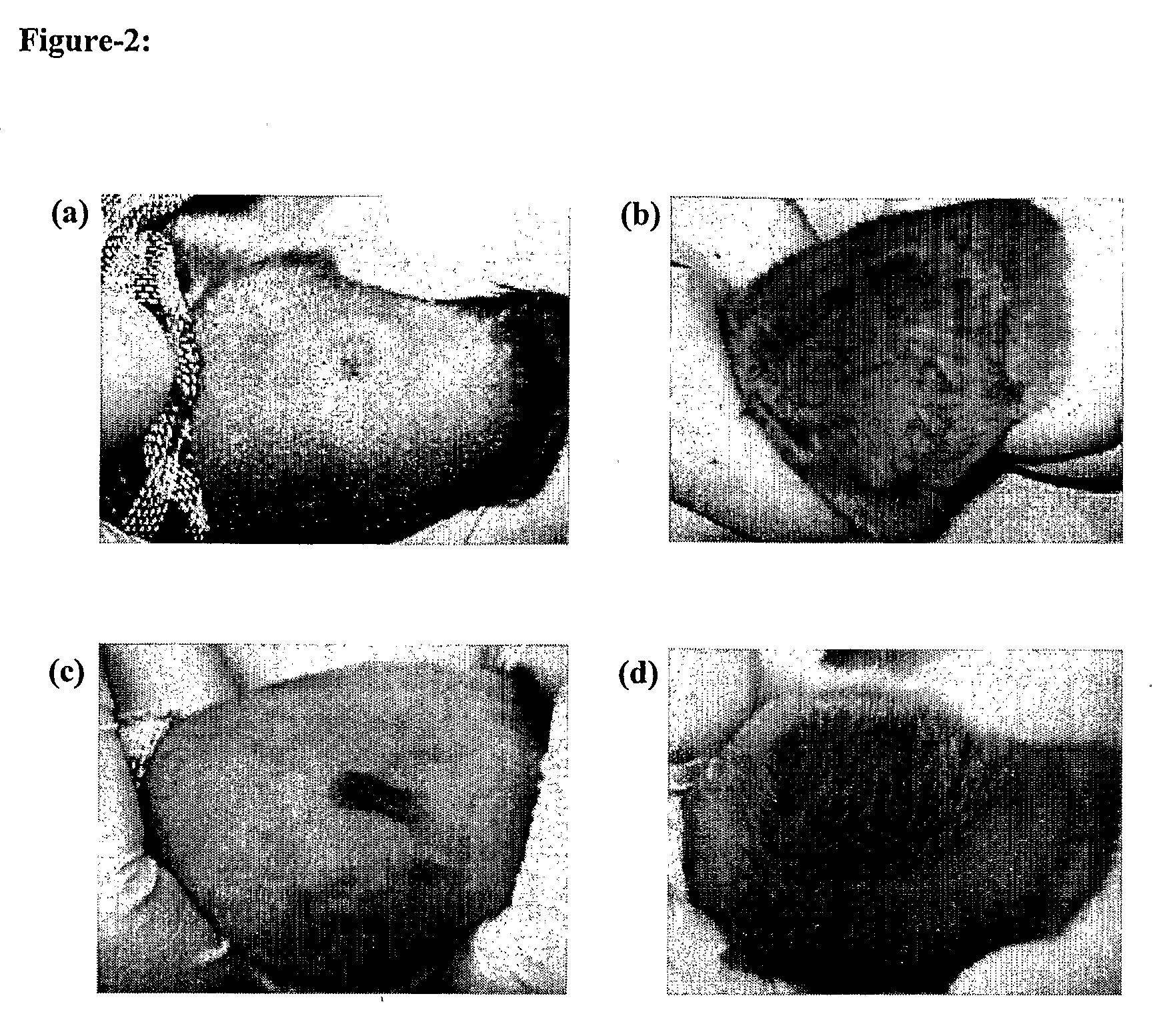 Novel compositions for hair disorders and process of preparation thereof