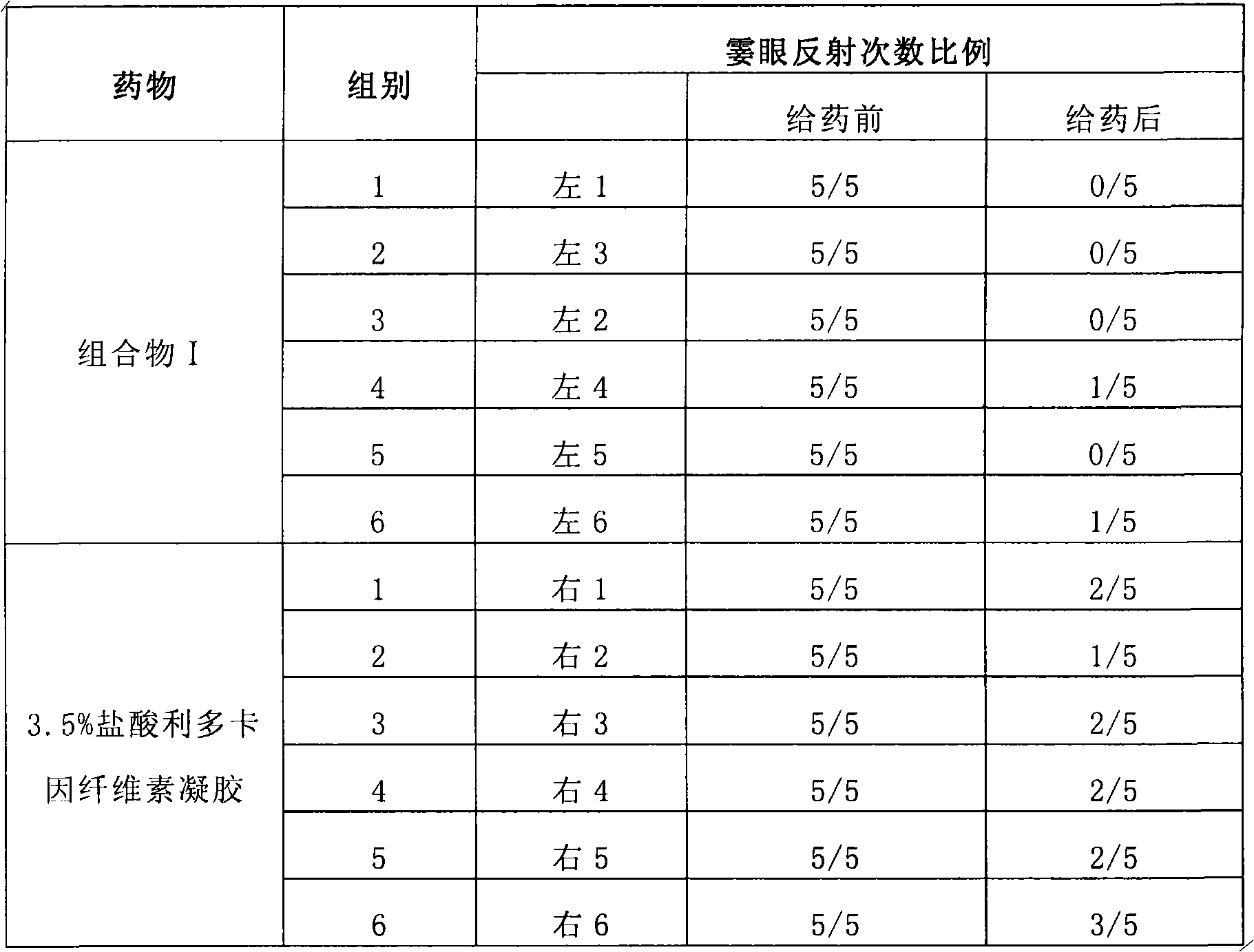 Composite for local anesthesia before ophthalmologic operation and preparation method and application thereof