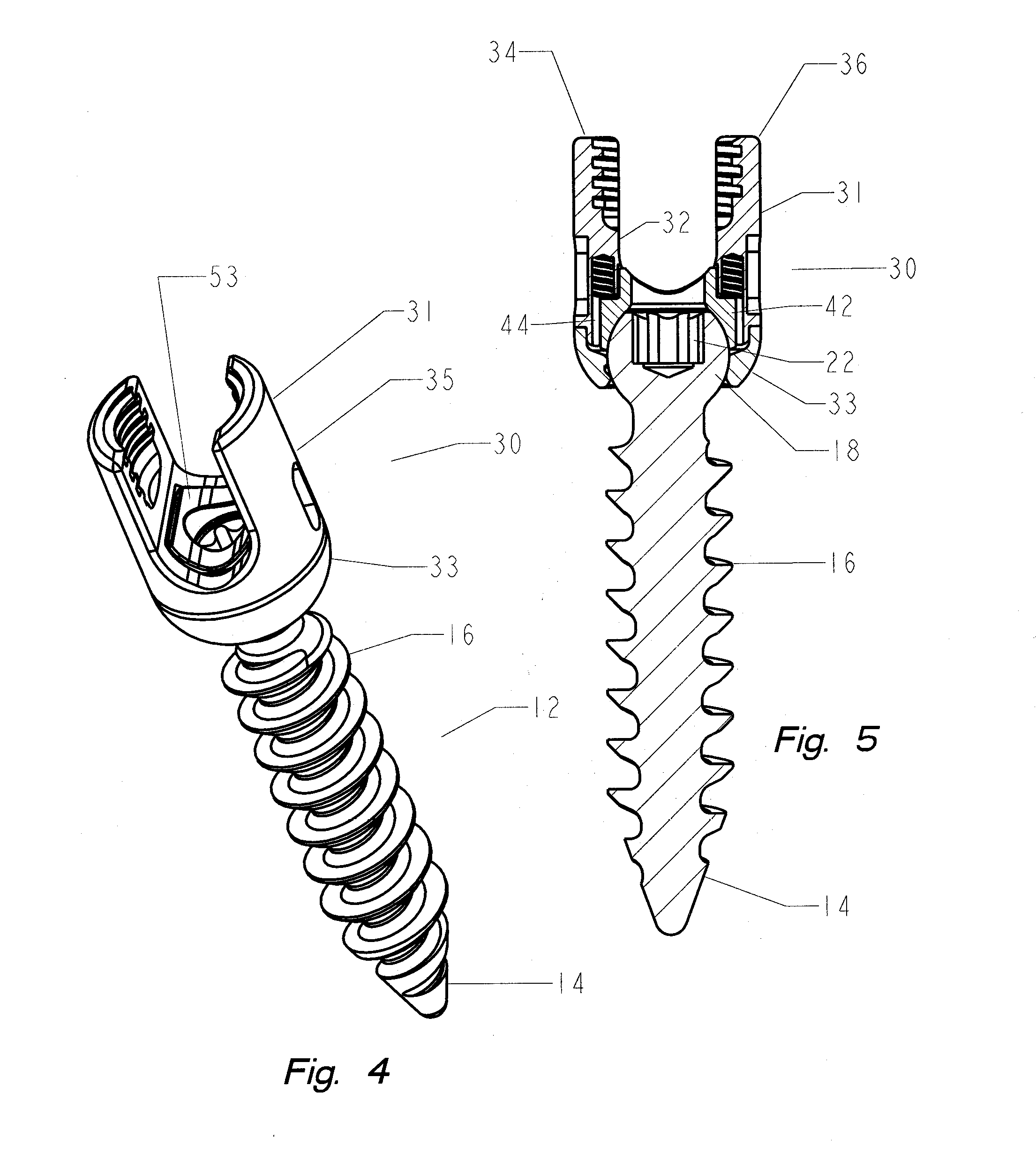 Thread-thru polyaxial pedicle screw system