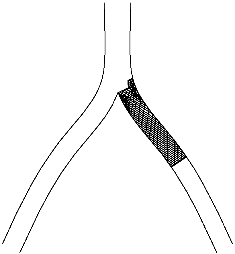 Stent for near bifurcation part lesion