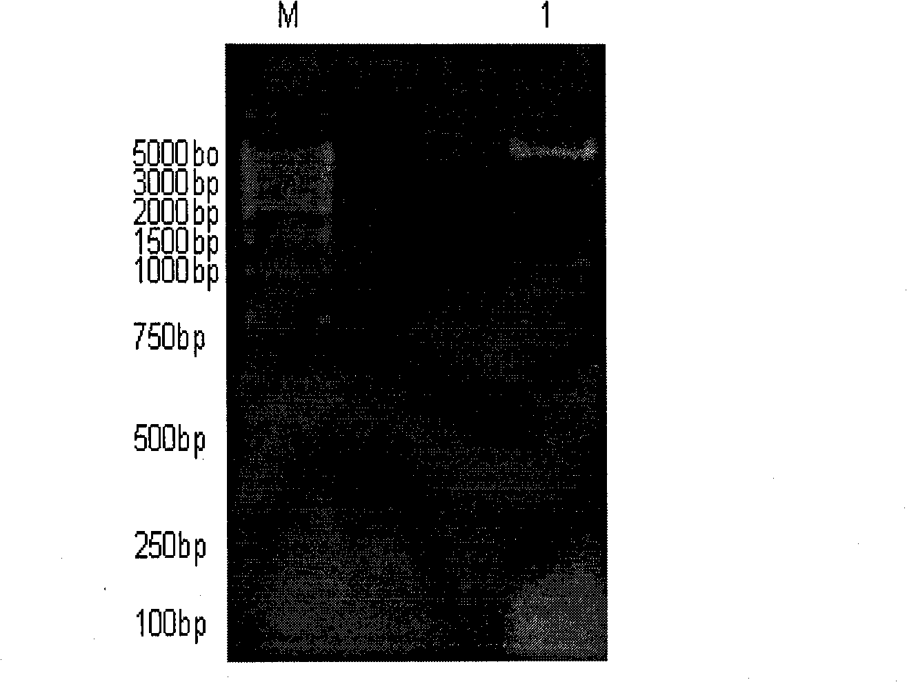 Inhibin DNA vaccine capable of improving animal fertility, and preparation and use thereof