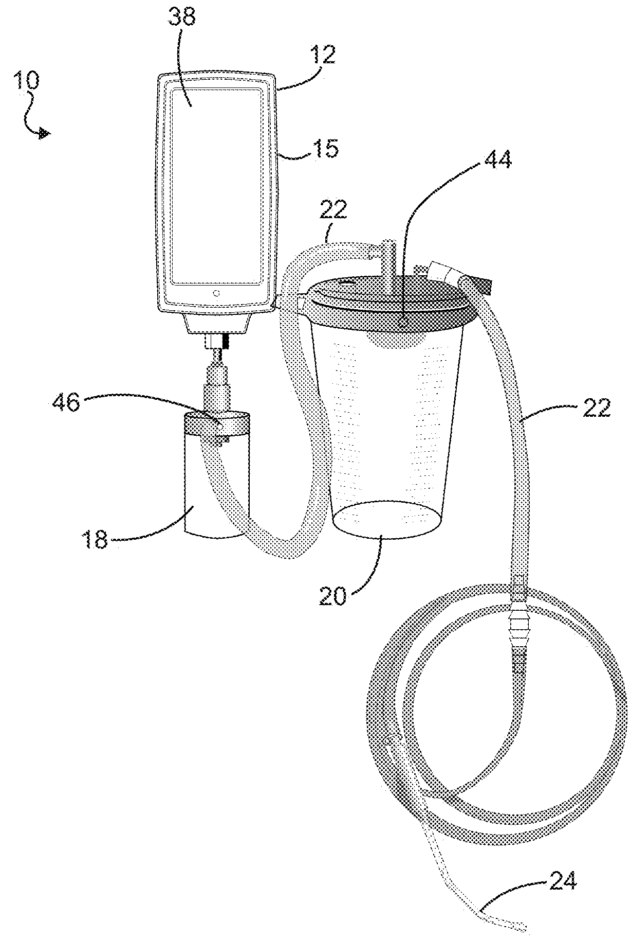 Electronic vacuum regulator device