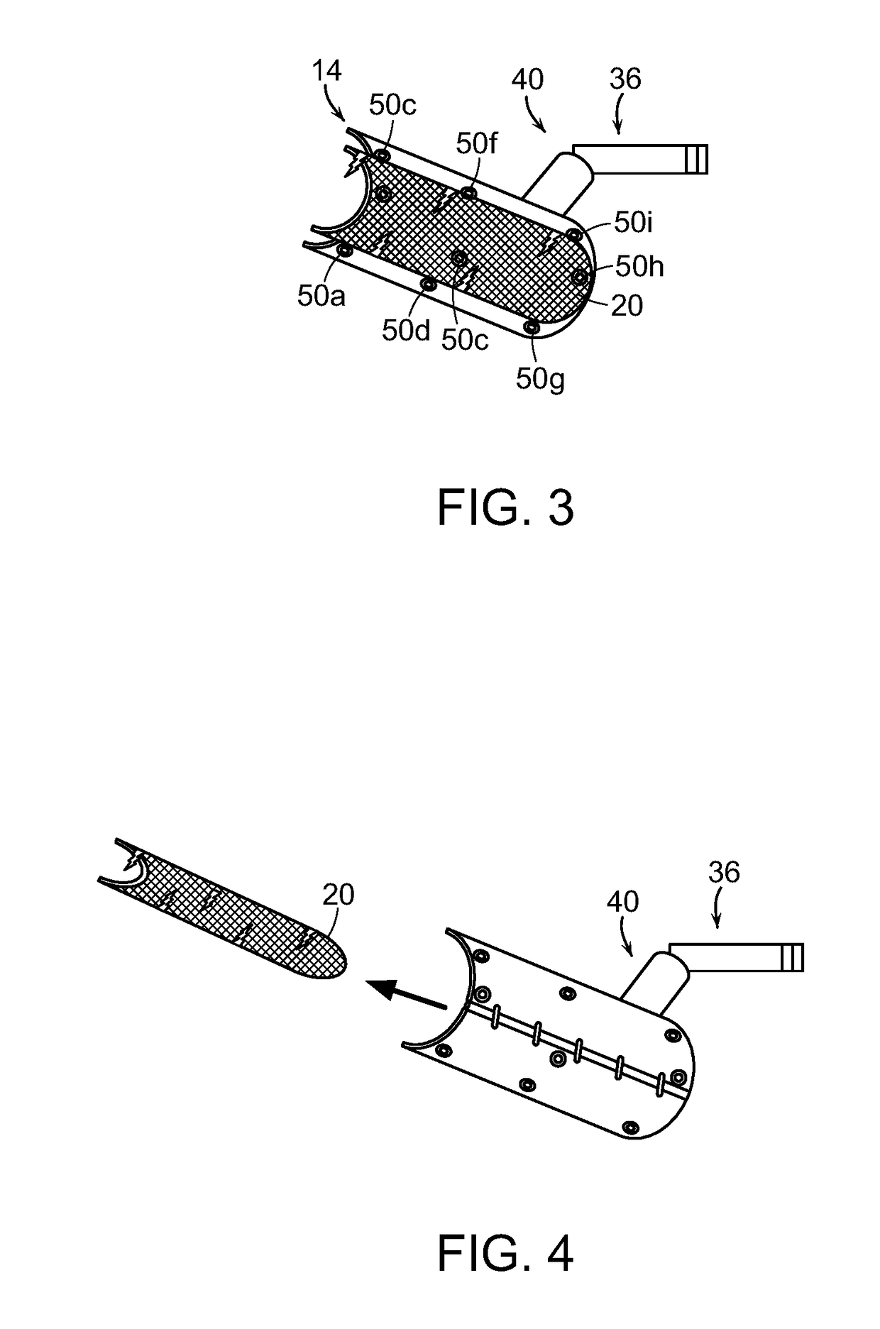 Delivery system for positioning and affixing surgical mesh or surgical buttress covering a surgical margin