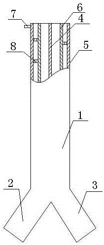 An inflatable double-lumen endotracheal tube for anesthesia