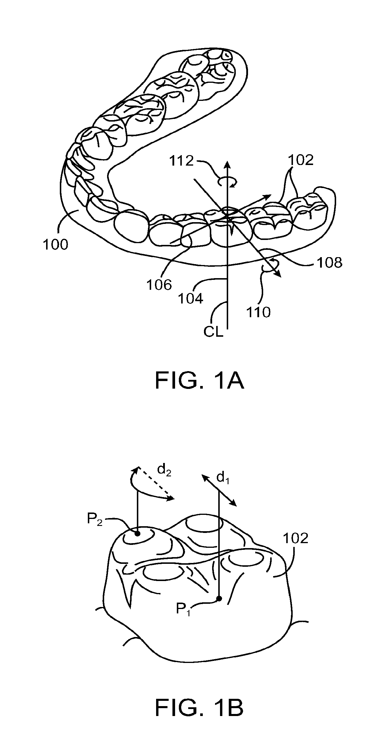 Computer automated development of an orthodontic treatment plan and appliance