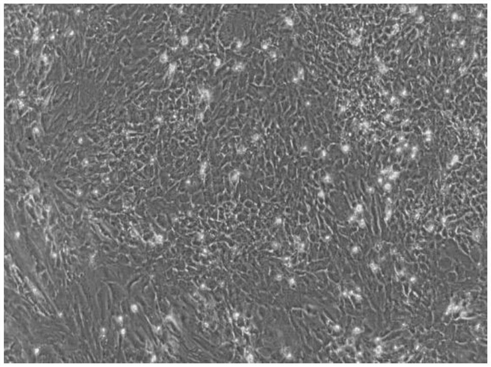 A kind of mixed stem cell injection containing three kinds of angiogenesis properties and its preparation method