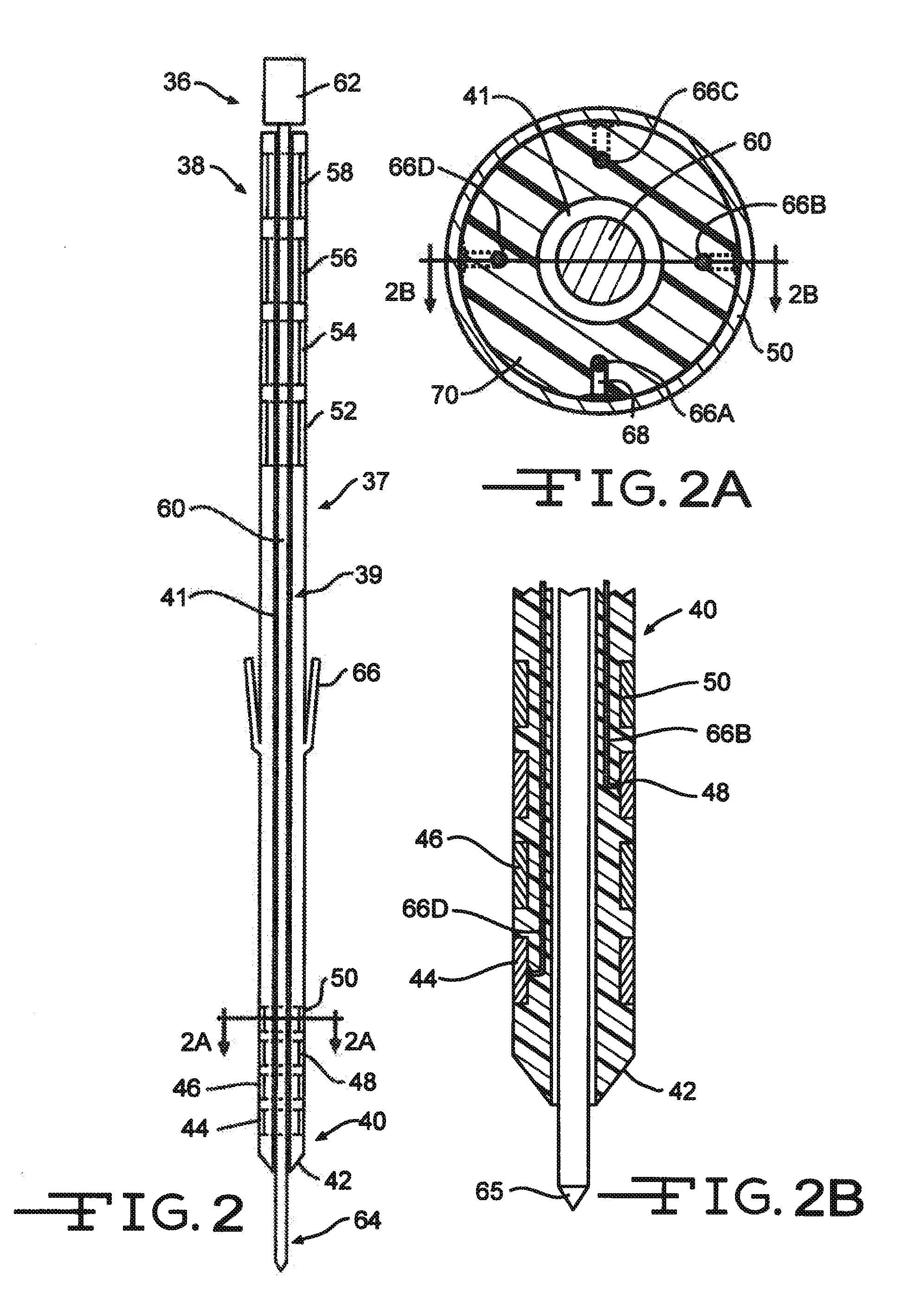 Minimally invasive methods for implanting a sacral stimulation lead