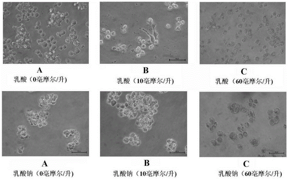 B lymphocytoblast model realizing differentiation of epithelioid cells through lactic acid induction as well as construction and application of B lymphocytoblast model