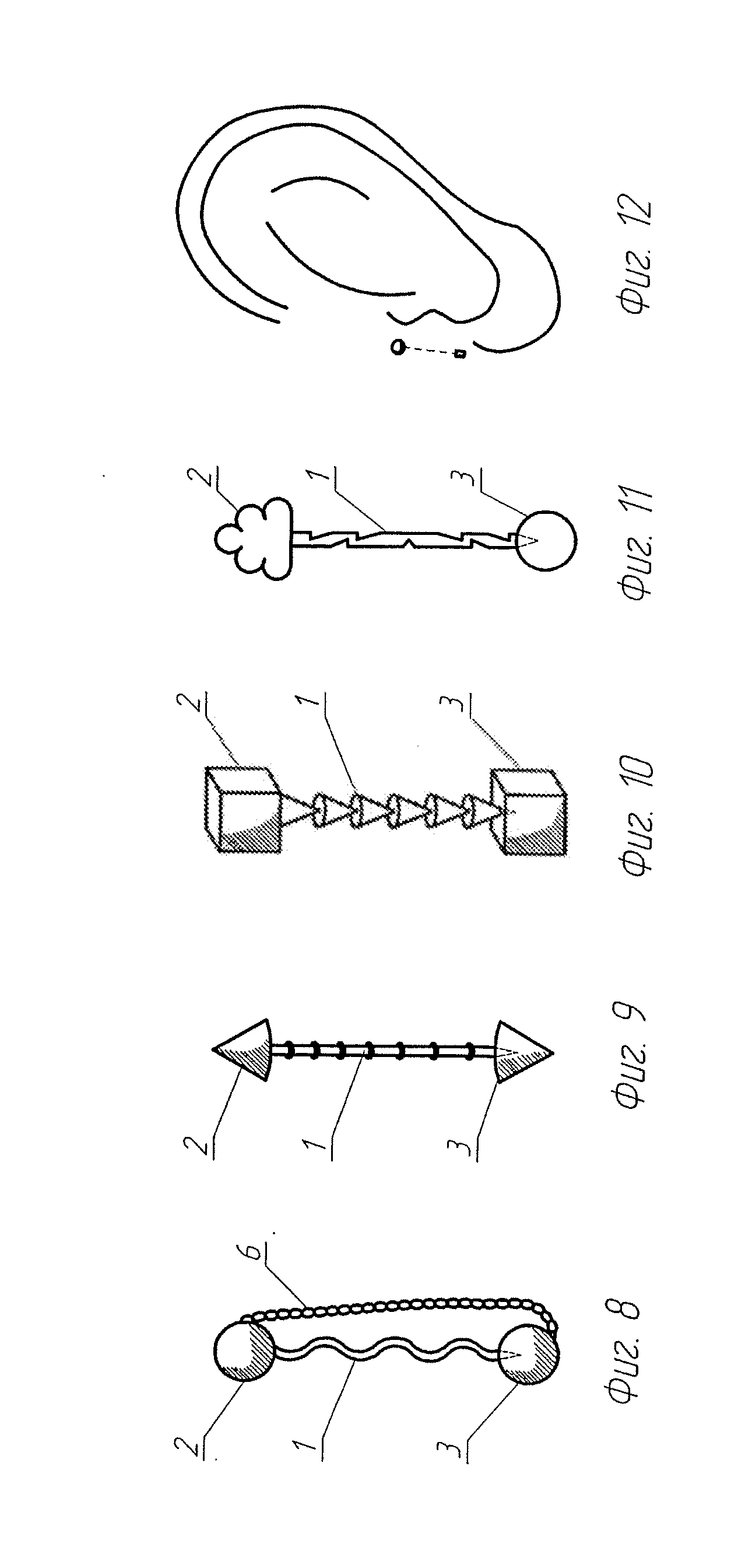 Method for Prolonging the Action on Acupuncture Points Including for Reducing the Excessive Body Weight and for Correcting the Body, a Device and a Needle (Variants) for Carrying Out Said Method