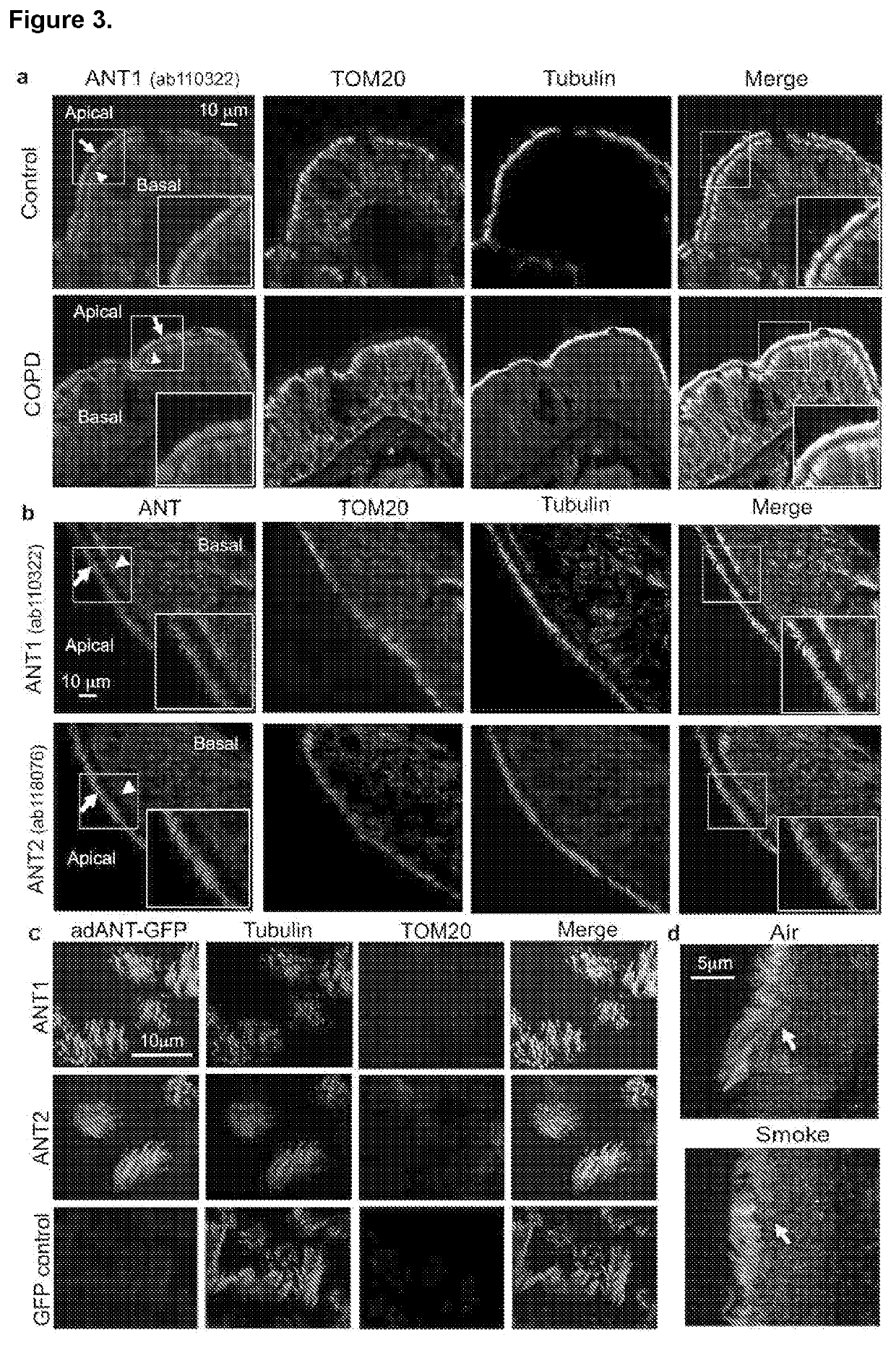 Lung cell treatments to prevent or treat disease