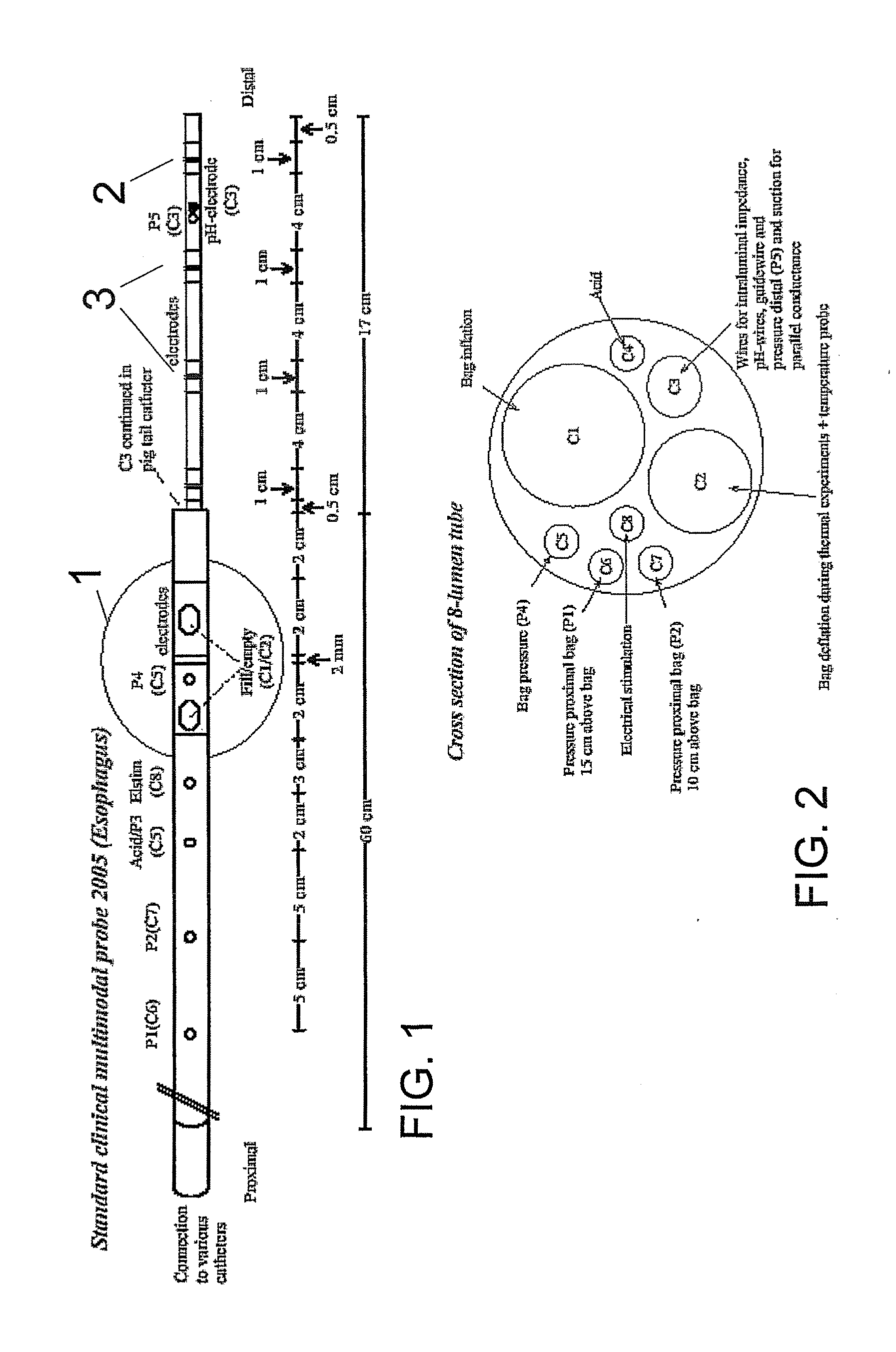Apparatus and method for a global model of hollow internal organs including the determination of cross-sectional areas and volume in internal hollow organs and wall properties