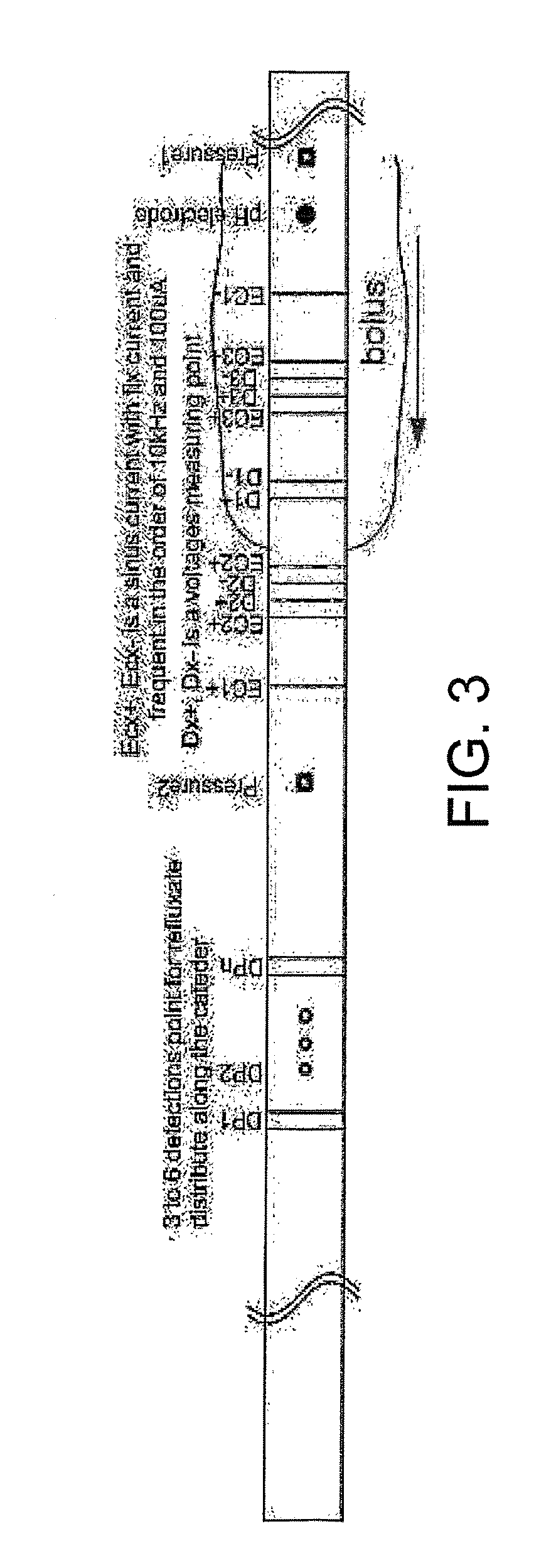 Apparatus and method for a global model of hollow internal organs including the determination of cross-sectional areas and volume in internal hollow organs and wall properties