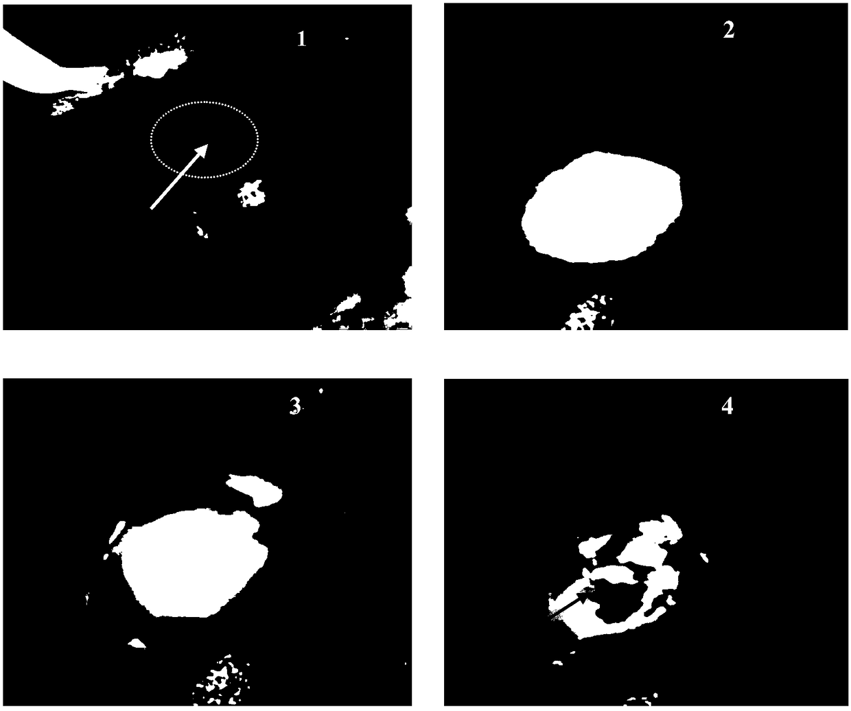 A kind of multifunctional microporous hemostatic powder and preparation method thereof