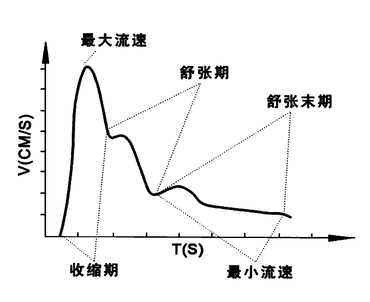 Evaluation index used for evaluating heart intervene curative effects, control system and system used for evaluating heart intervention curative effects