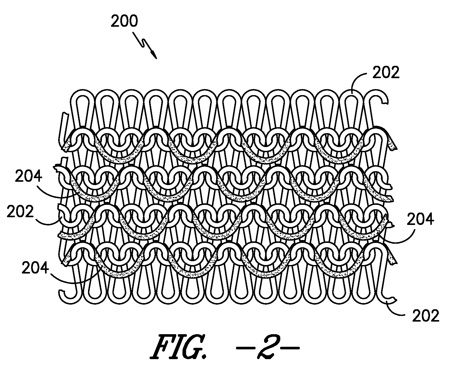 Composite article suitable for use as a wound dressing