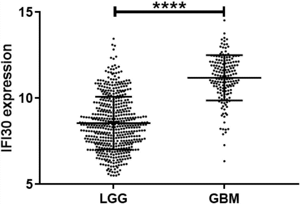 Auxiliary glioblastoma diagnosis and prognostic evaluation kit based on IFI30 gene and using method thereof