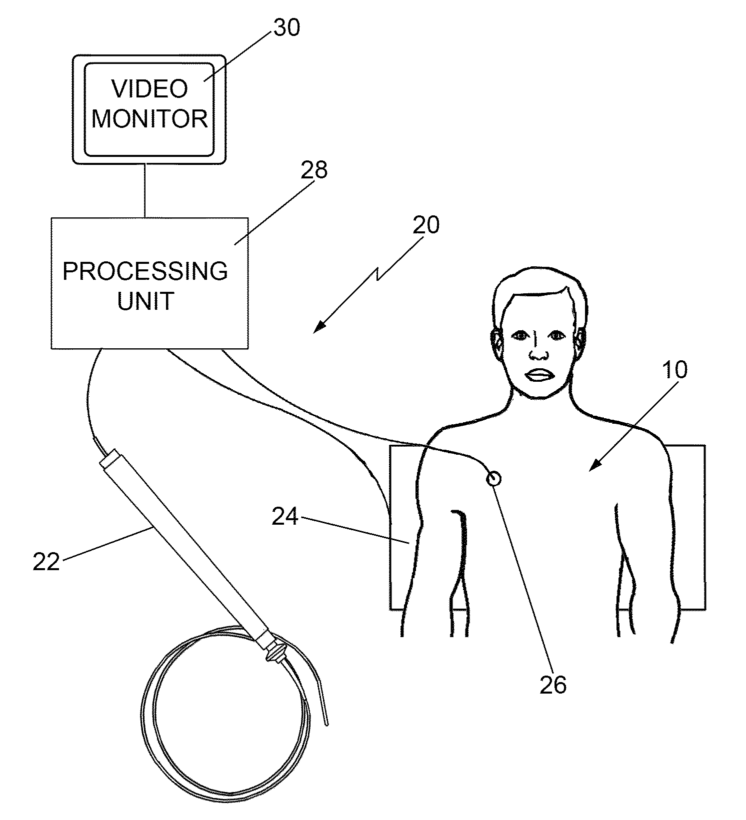 Cardio mapping system and method for cardio mapping