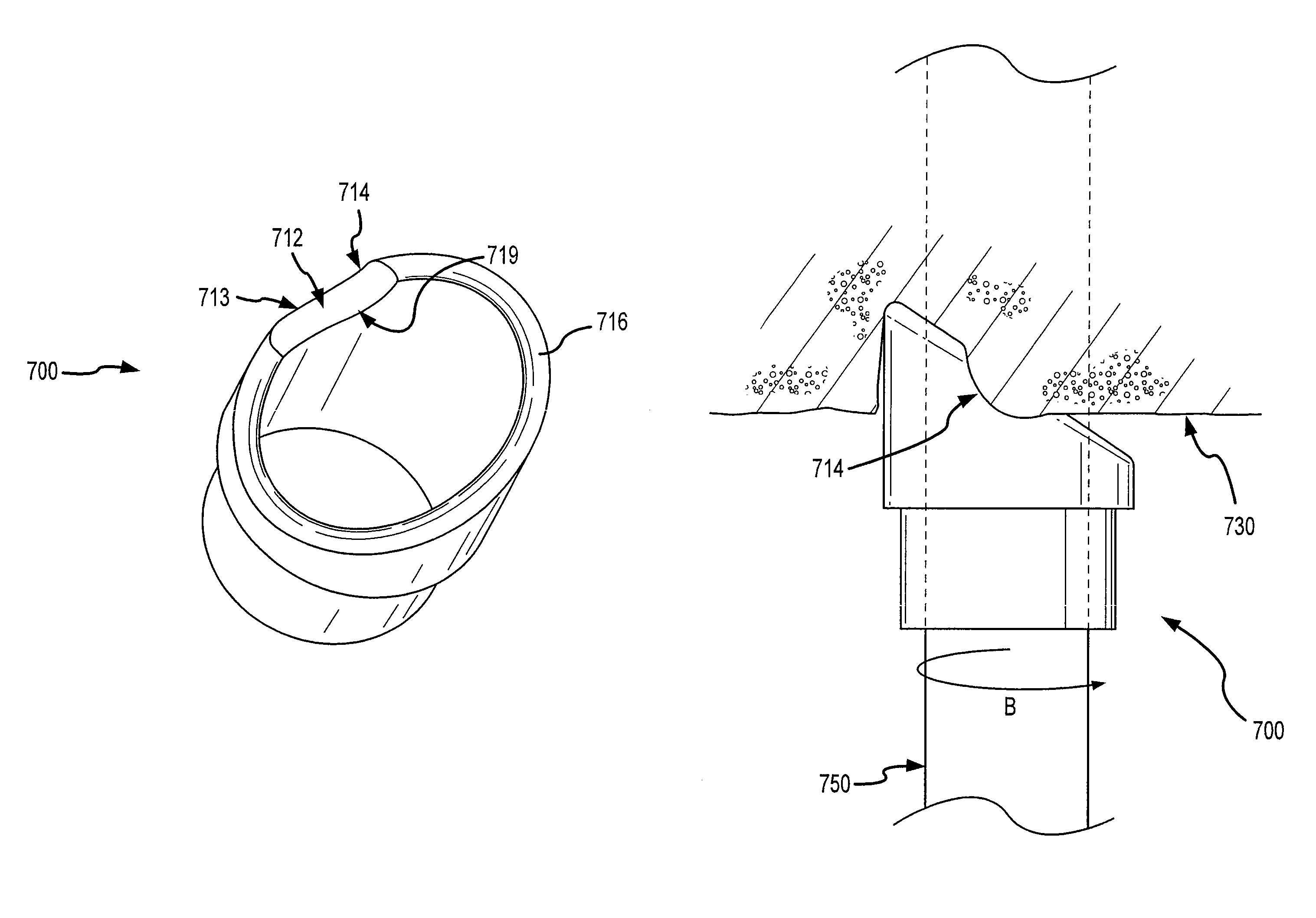 Tissue separating systems and methods