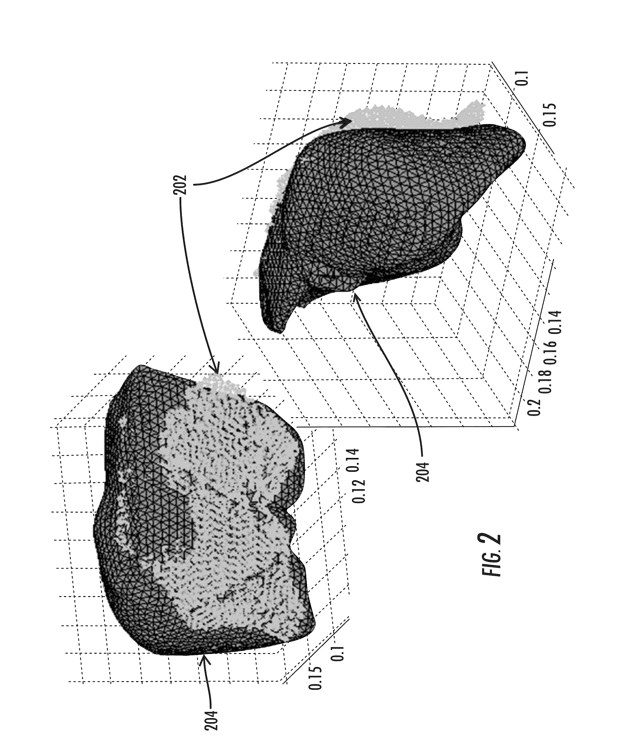 Enhanced method for correcting data for deformations during image guided procedures