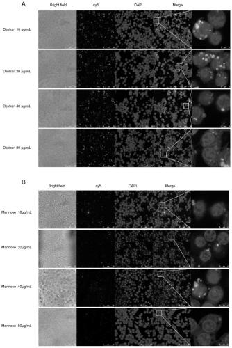 siRNA for inhibiting HMGB1 gene, stable nucleic acid lipid nanoparticle containing siRNA, and application of siRNA and stable nucleic acid lipid nanoparticle
