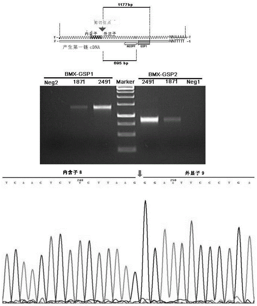 A BMX spliceosome and applications thereof in lung cancer drug resistance