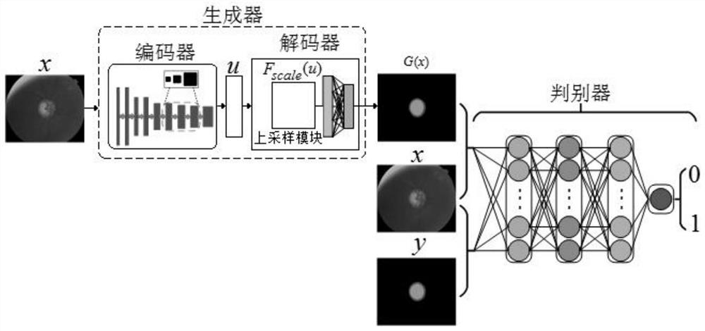 Eye fundus retina image segmentation method based on deep convolutional neural network