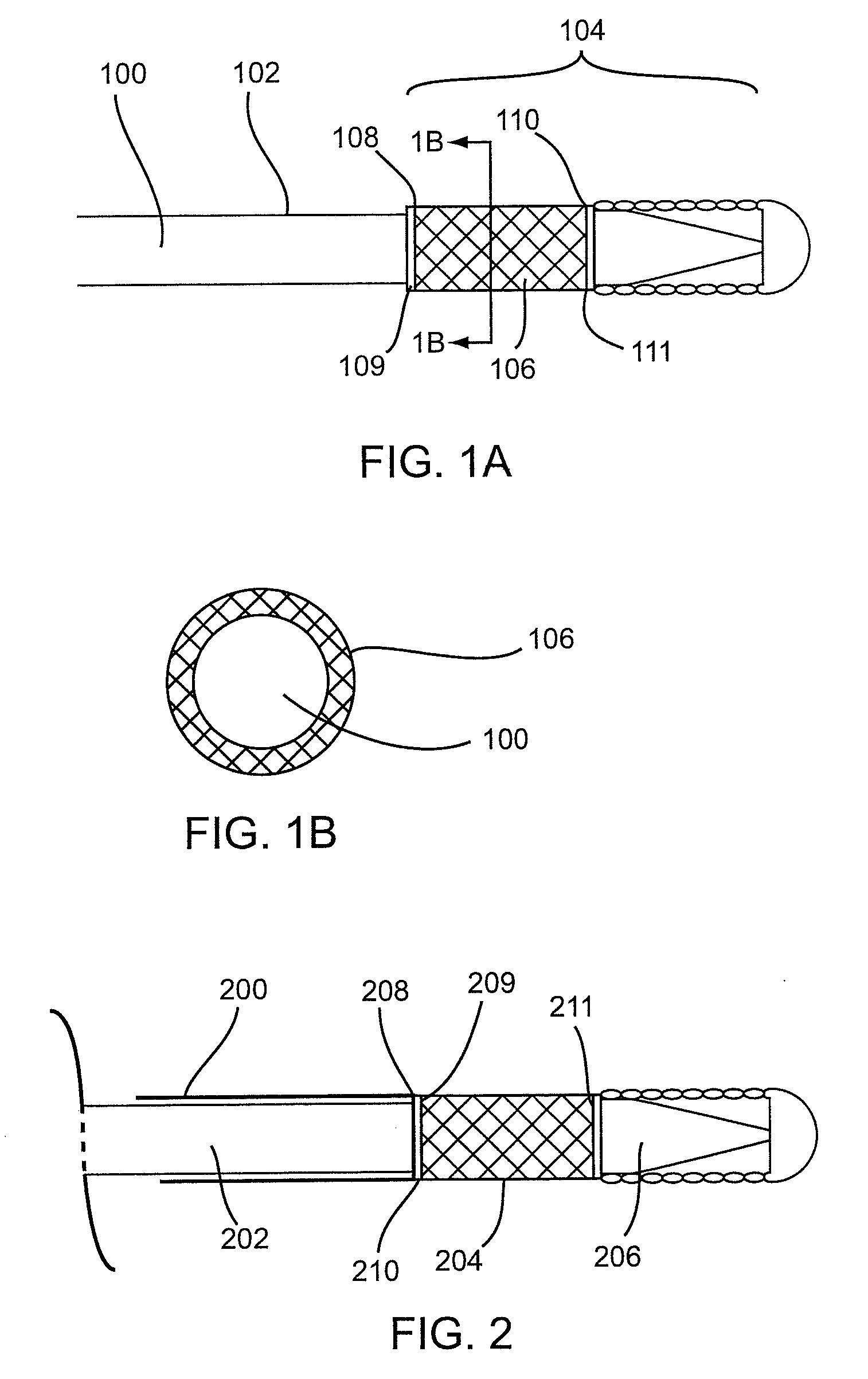 Implant delivery technologies