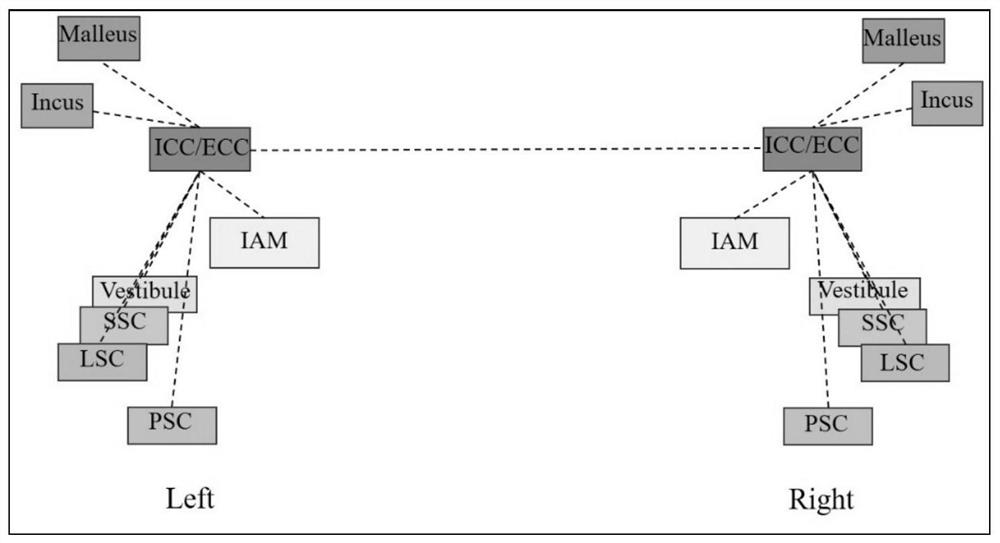 Temporal bone key anatomical structure automatic positioning method based on spatial relative position prior