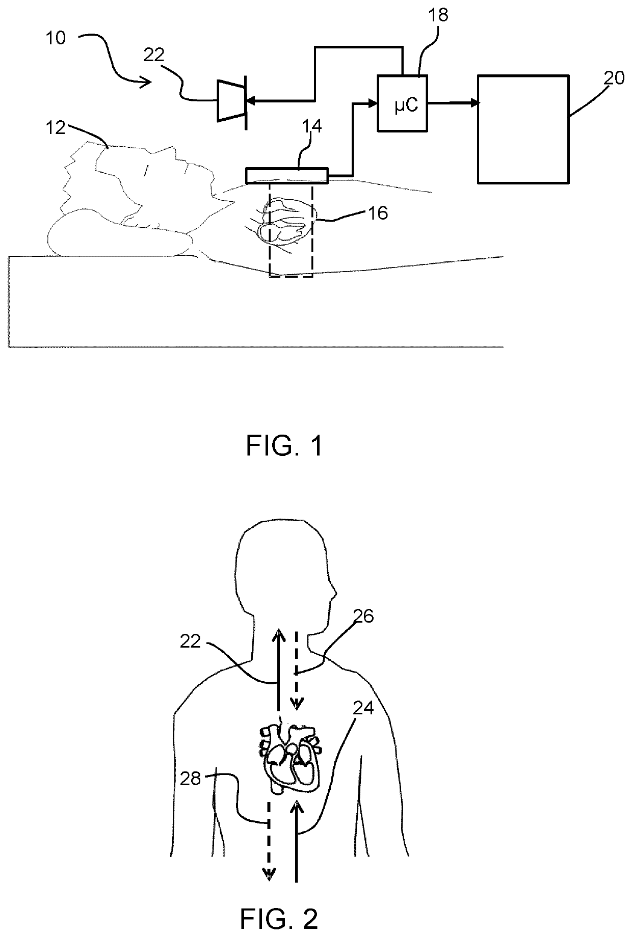 A sleep monitoring system and method