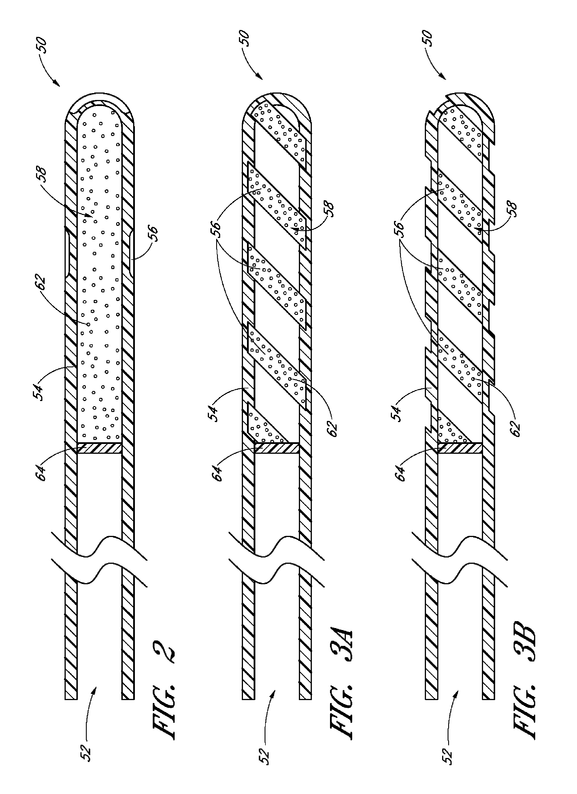 Implants with controlled drug delivery features and methods of using same