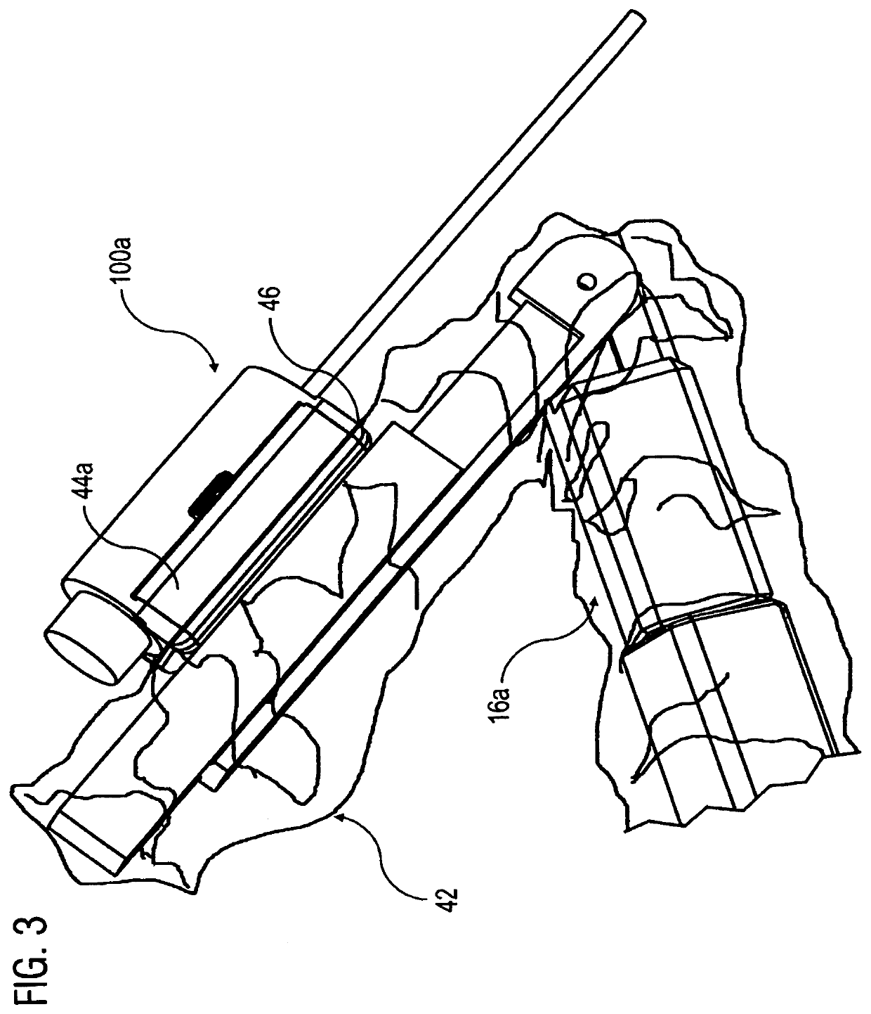 Device for robot-assisted surgery