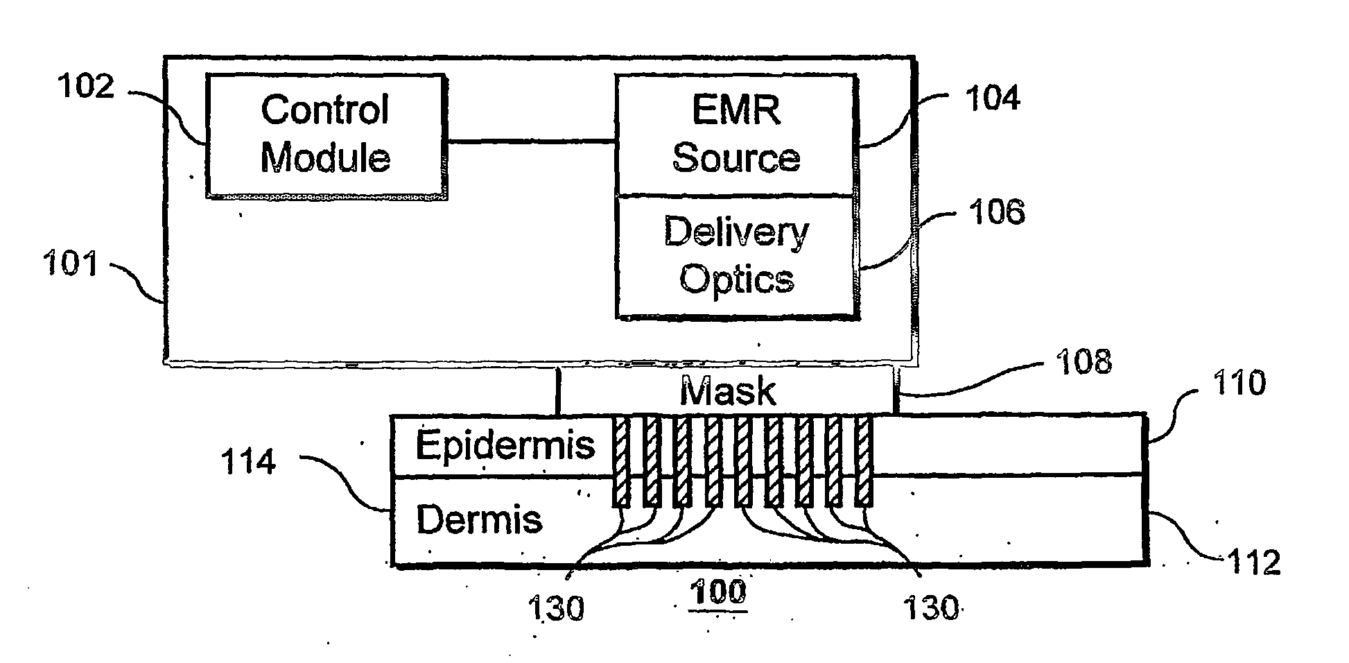 Method and apparatus for dermatological treatment and fractional skin resurfacing