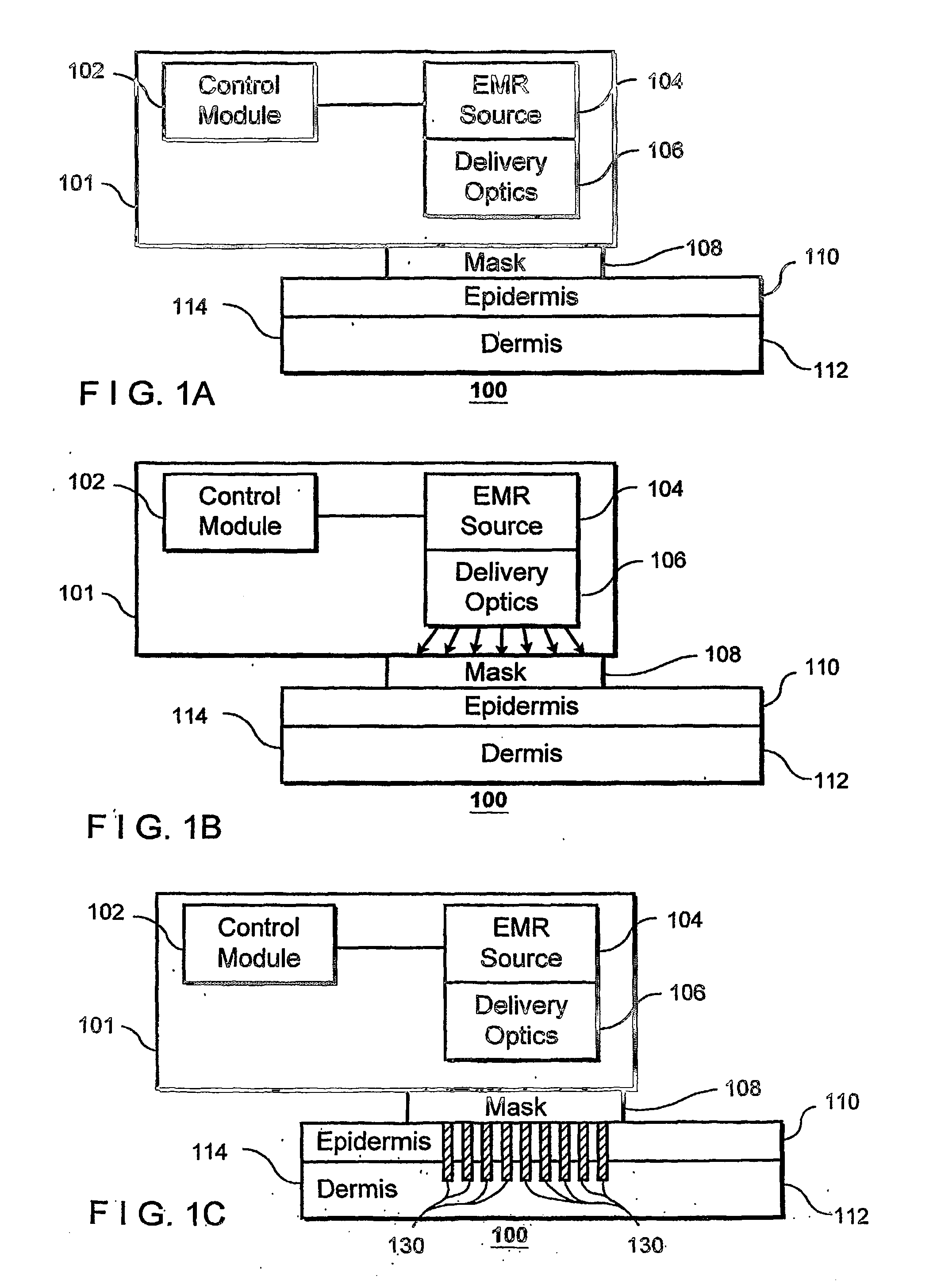 Method and apparatus for dermatological treatment and fractional skin resurfacing