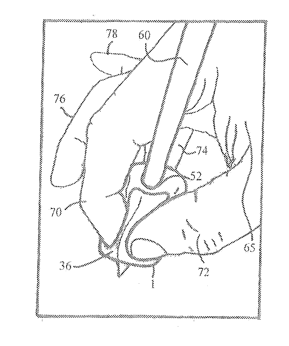 Grip for hand-held tools and method of using the same