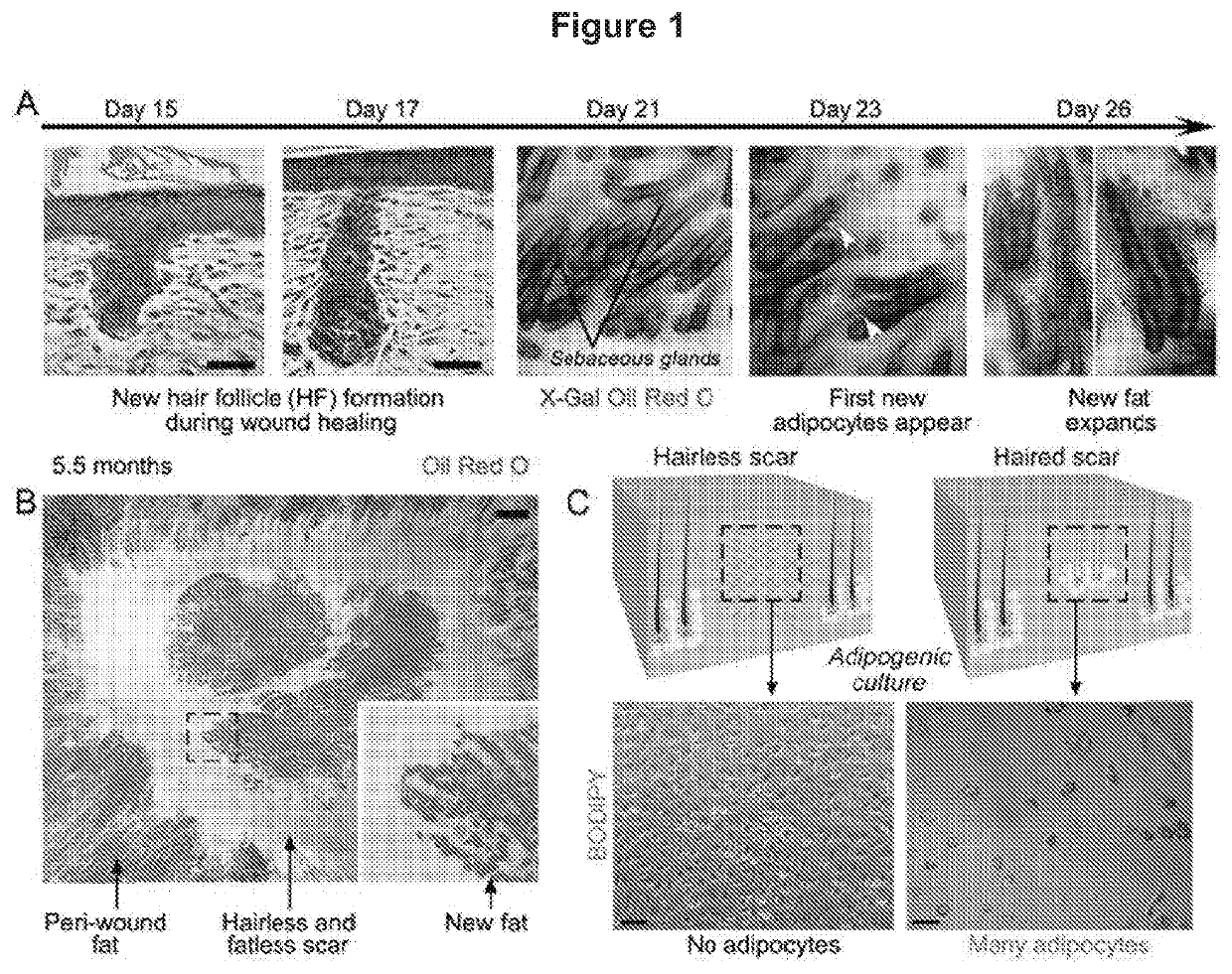 Methods for scar reduction by converting scar fibroblasts into adipocytes with hair follicle-derived signals