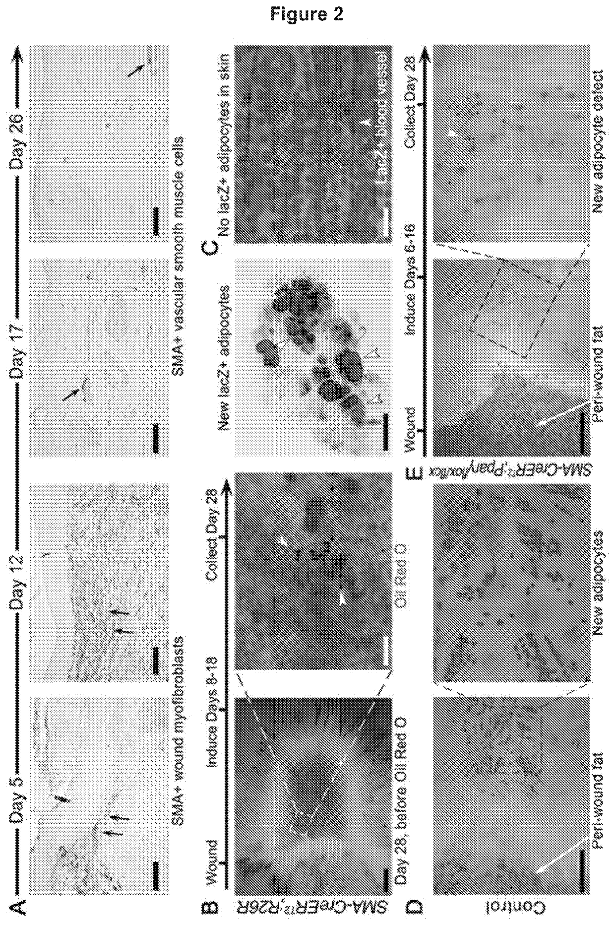 Methods for scar reduction by converting scar fibroblasts into adipocytes with hair follicle-derived signals