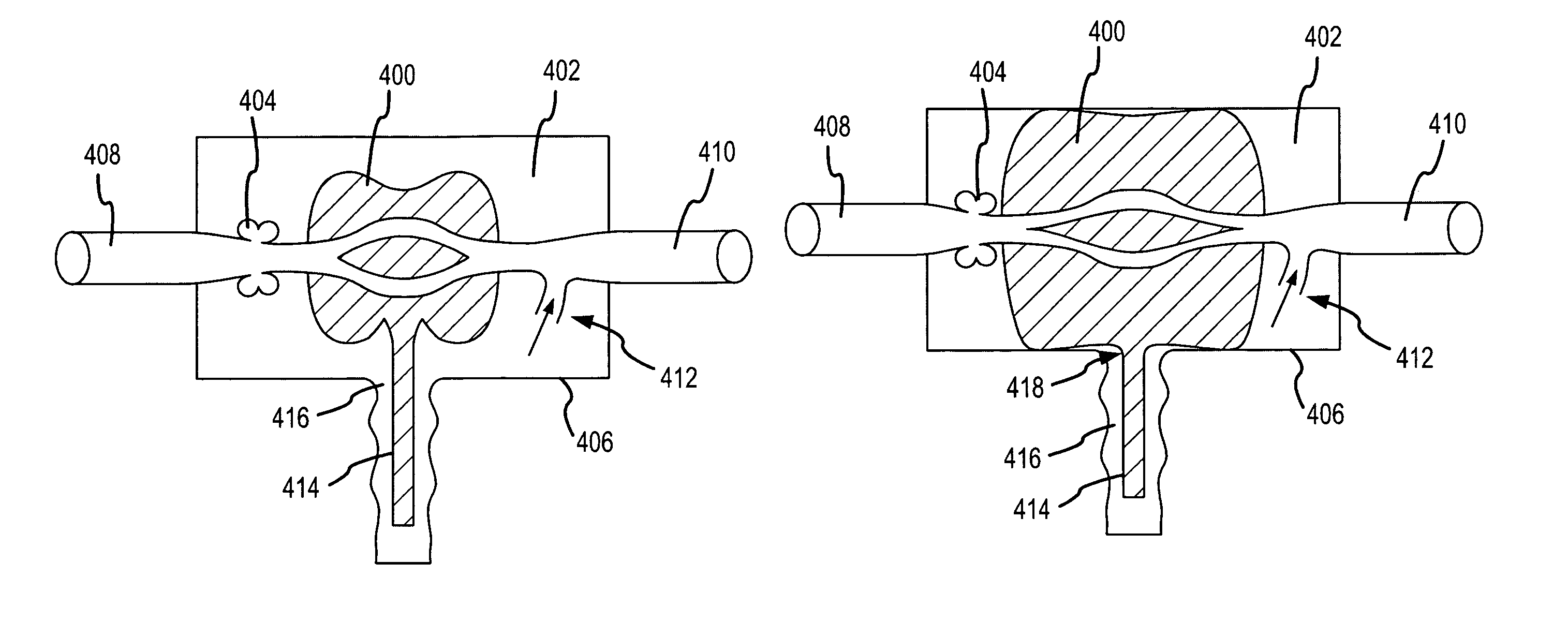 Systems and methods for increasing cerebral spinal fluid flow